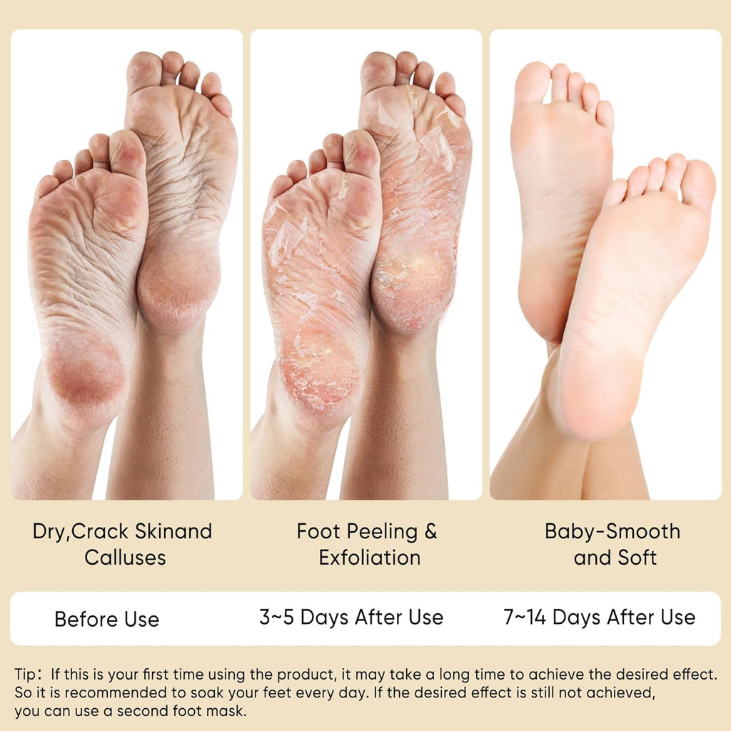 Coconut Foot Mask